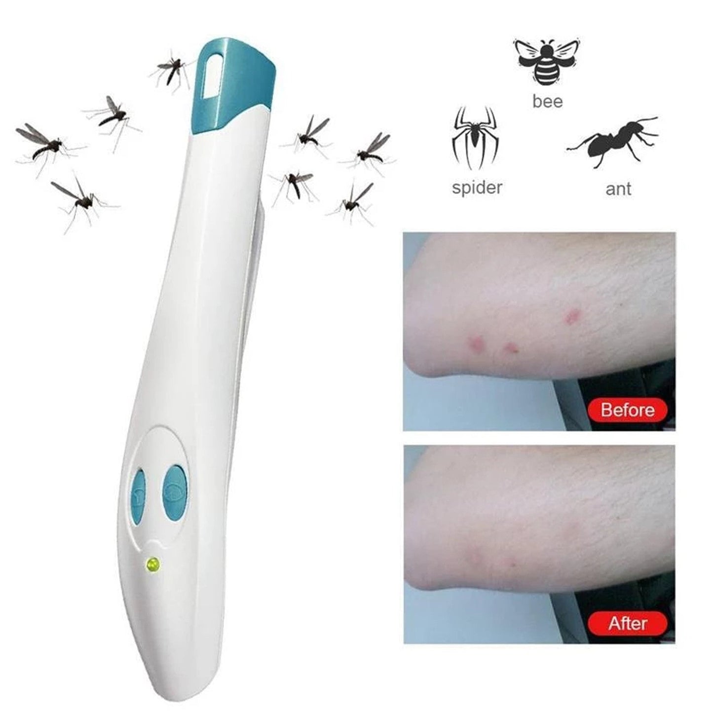 Mosquito Bite Relief Pen - Portable, Eco-Friendly Itch Soother