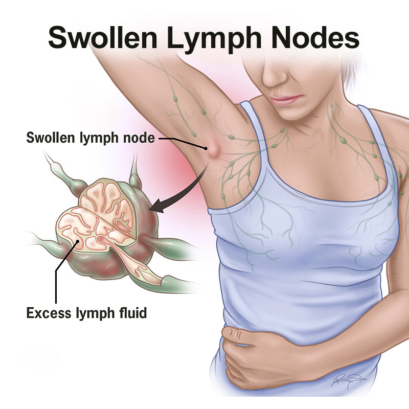 Lymphatic Health Adhesive Patch for Swelling and Detox