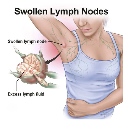 Lymphatic Health Adhesive Patch for Swelling and Detox