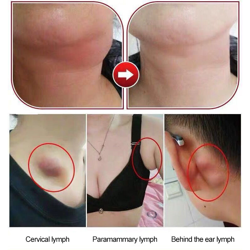 Lymphatic Health Adhesive Patch for Swelling and Detox
