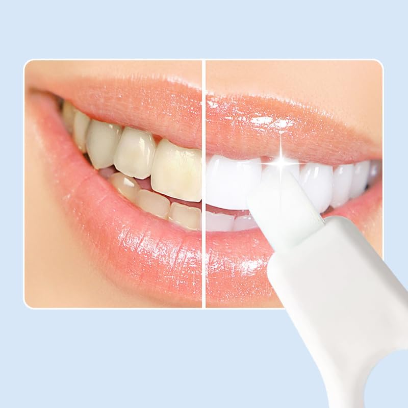 Tooth Cleaning Brush – PP + Sponge – 3-Pack – White