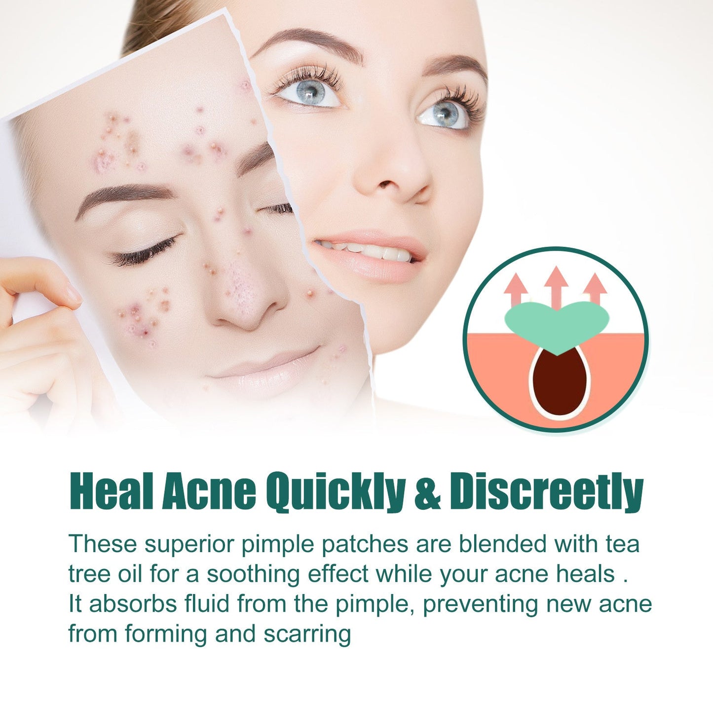 Heart-Shaped Colorful Acne Patches - Eco-Friendly Skincare Solution