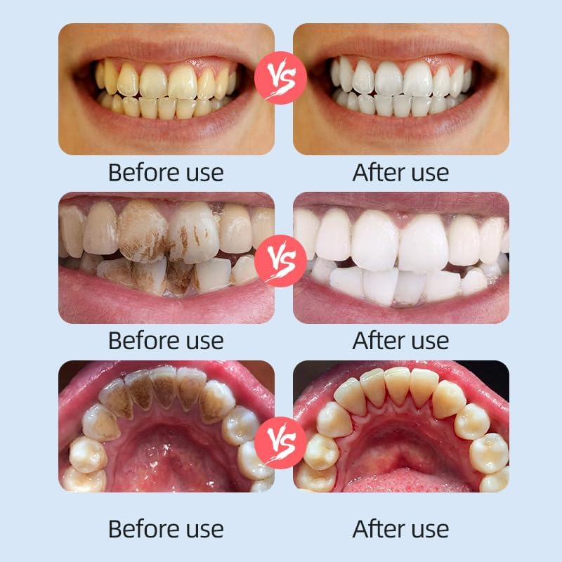 Tooth Cleaning Brush – PP + Sponge – 3-Pack – White