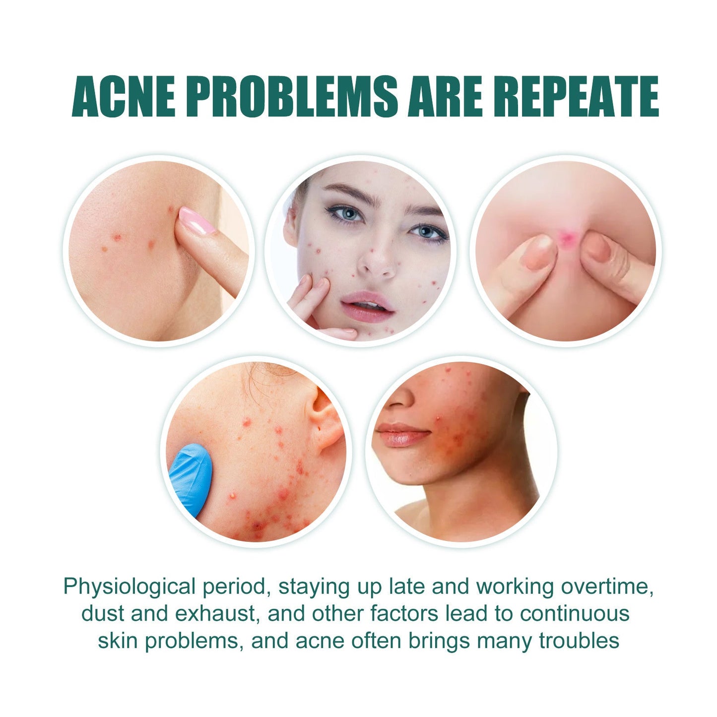 Heart-Shaped Colorful Acne Patches - Eco-Friendly Skincare Solution