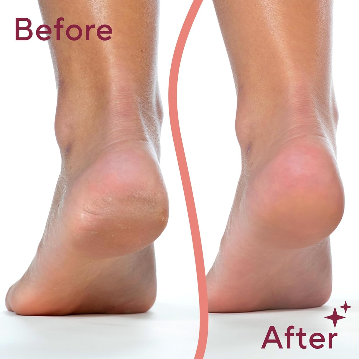 Touch Flawless Pedi, Electronic Tool, File and Callus Remover, Pedicure