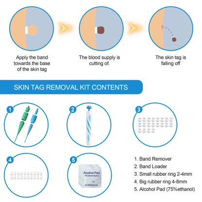 Eco-Friendly Auto Skin Tag Remover Kit - Reusable Personal Care Tool